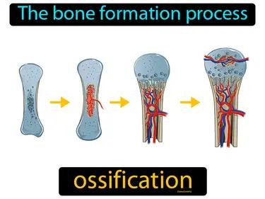 ossification Simple Definition