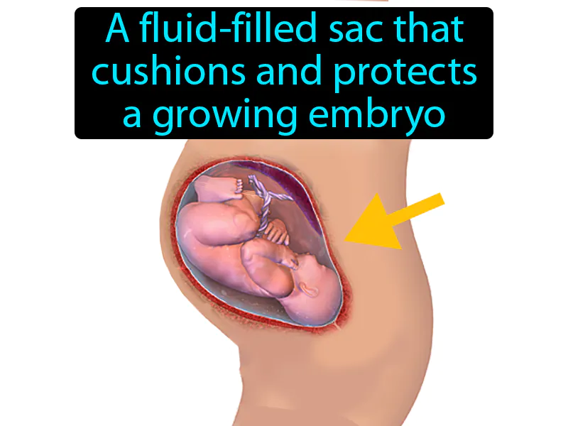 Amniotic Sac Definition Amniotic Sac Definition